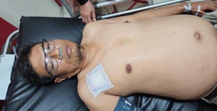 Motor Korban Perampokan di Bukittinggi Ditemukan, Uang Rp70 Juta Dilarikan