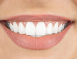 Ini Tips Membuat Gigi Putih Bersih dan Sehat dengan Bahan Rumahan