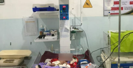 Bayi malang menderita gizi buruk.