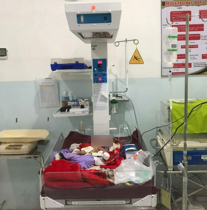 Bayi malang menderita gizi buruk.