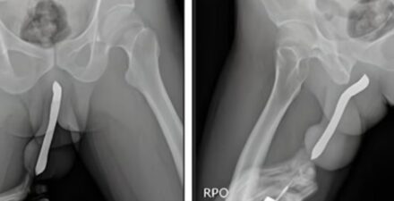 Kejadian Mengejutkan, Pria NeKat Masukkan Sikat Gigi ke Alat Kelamin, Akhirnya Terluka Parah