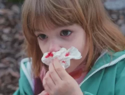 Penyebab dan Cara Menghindari Mimisan Menurut Ahli Kesehatan