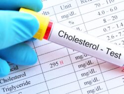 Waktu yang Dibutuhkan untuk Turunkan Kolesterol dengan Pola Makan