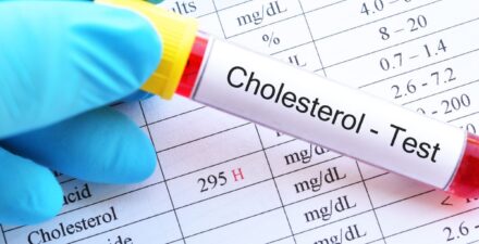 Waktu yang Dibutuhkan untuk Turunkan Kolesterol dengan Pola Makan