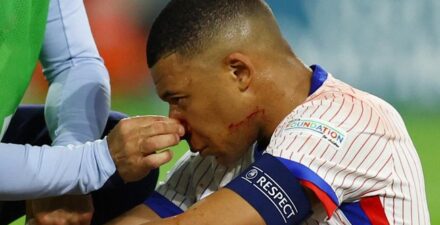 Kiper Austria Kritik Perilaku Mbappe Usai Cedera Patah Hidung