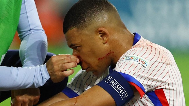 Mbappe