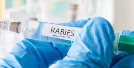 Rabies