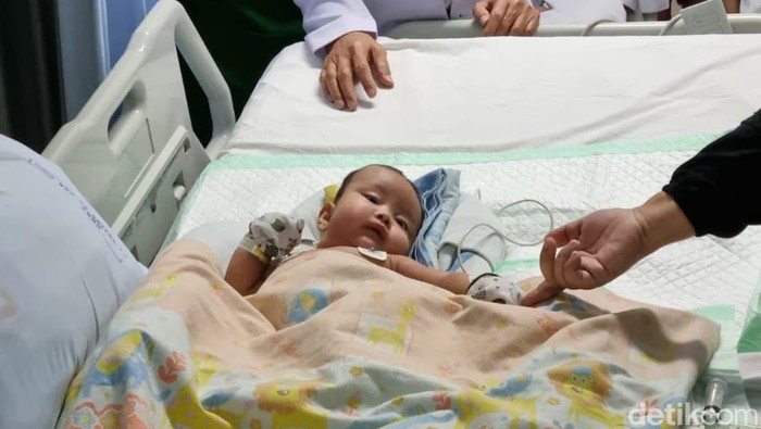 Operasi Pemisahan Kembar Siam