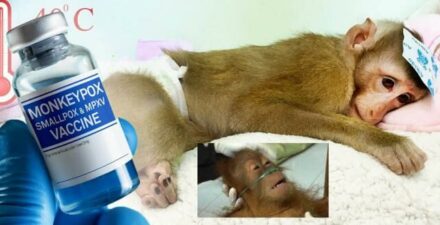 Wabah Cacar Monyet,  Apa Bedanya dengan Cacar Air?