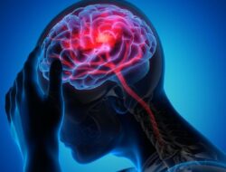 Menkes Ungkap Angka Kematian Stroke dan Jantung di Indonesia