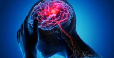 Menkes Ungkap Angka Kematian Stroke dan Jantung di Indonesia