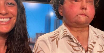 Joe DiMeo, Penerima Transplantasi Wajah dan Tangan Pertama, Melamar Jessica