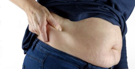 Penyebab Perut Buncit, Bukan Hanya karena Nasi!