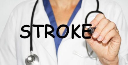 Golongan darah A disebut lebih rentan terkena stroke di usia muda.
