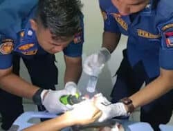 Cincin Terjepit, Tim Damkar Padang Selamatkan Jari Korban