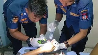 Tim Damkar Padang lepaskan cincin yang tersangkut di jari pasien RSUP DR. M Djamil Padang.