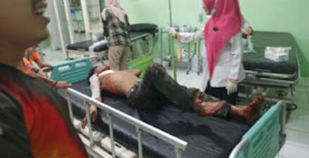 Satu Luka Bakar Serius.