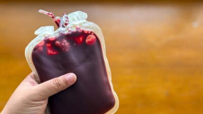Donor Darah Berapa Bulan Sekali? Ini Aturan Jeda yang Aman Menurut Medis
